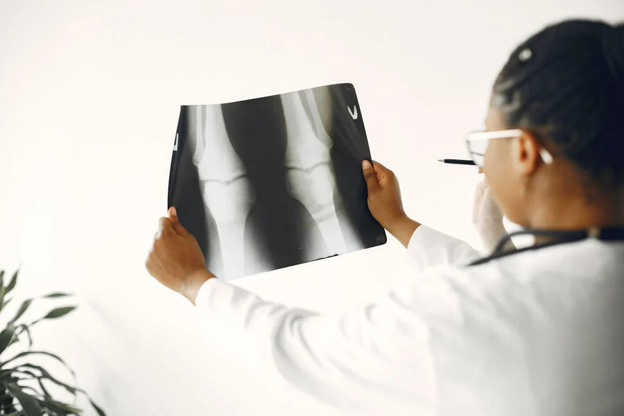 Recuperación Post-Artroscopia de Rodilla: Guía Completa Semana a Semana