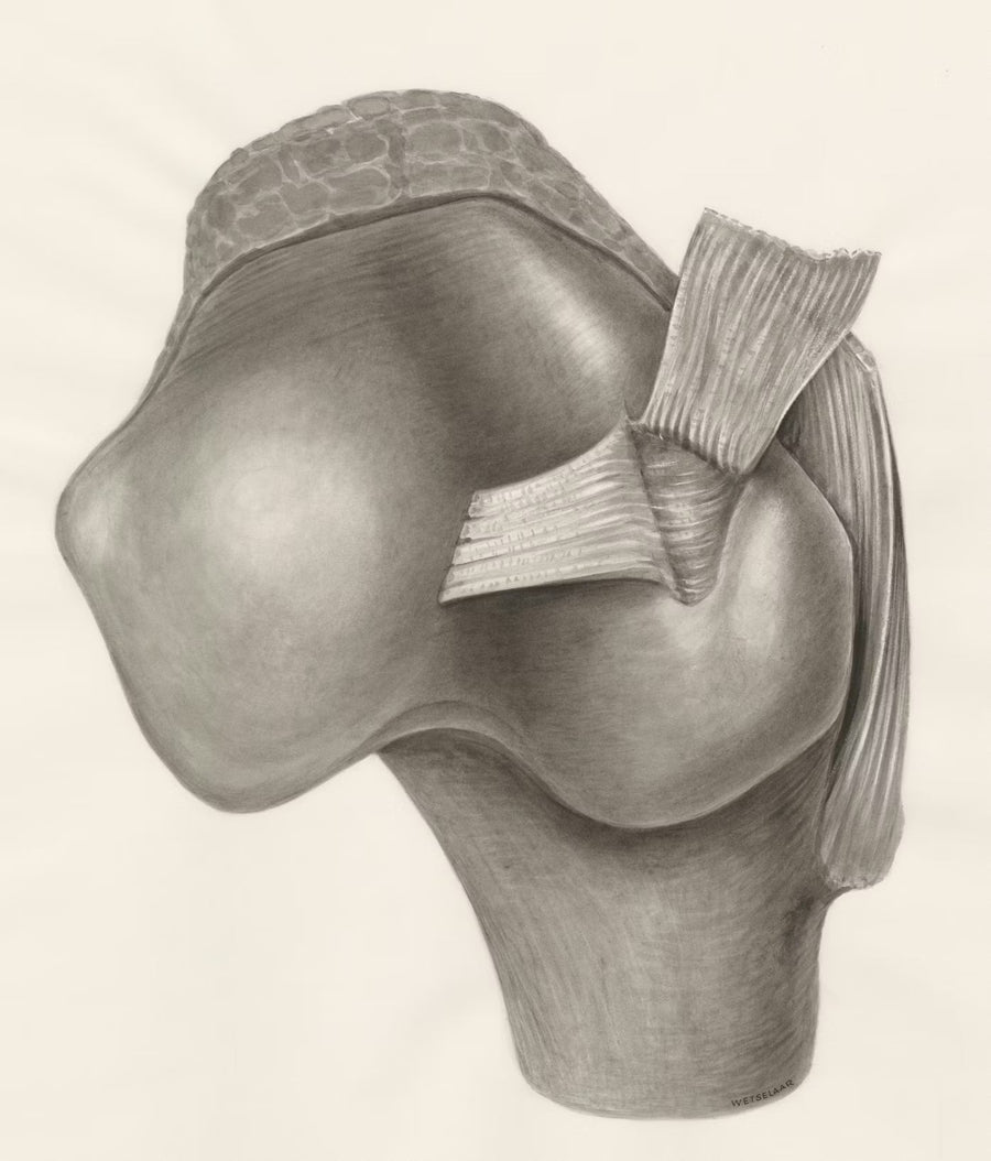 Artroscopía de rodilla: qué esperar antes, durante y después de la cirugía