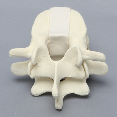 Sawbones Vértebras lumbares L4-L5 cortical de espuma