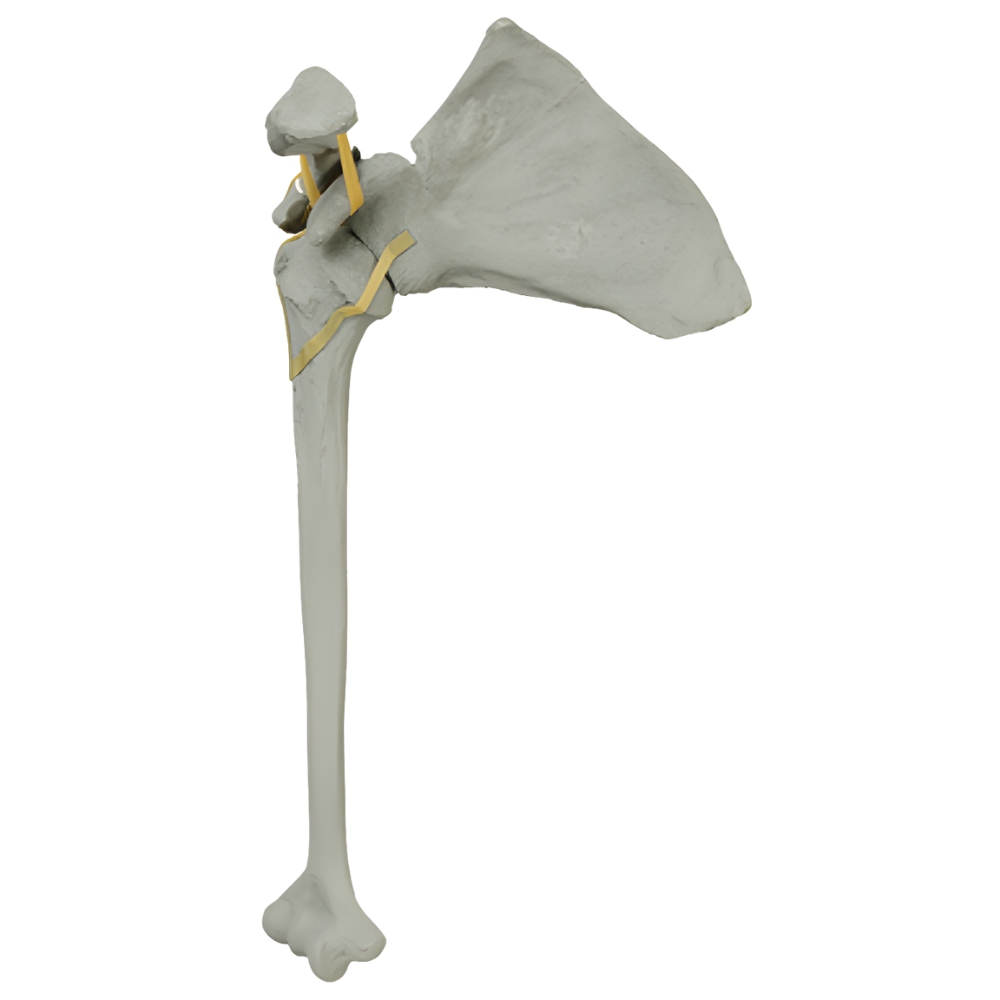 HOMBRO CON PROPIEDADES RADIOPACAS, DERECHO SAWBONES