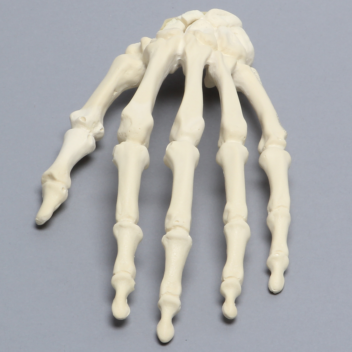 Sawbones Mano con fractura de escafoides