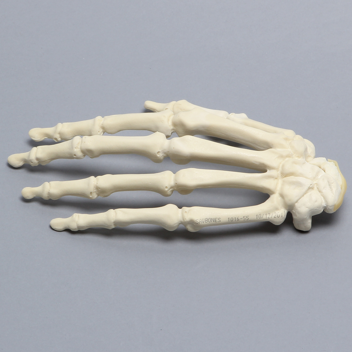 Sawbones Mano con fractura de escafoides