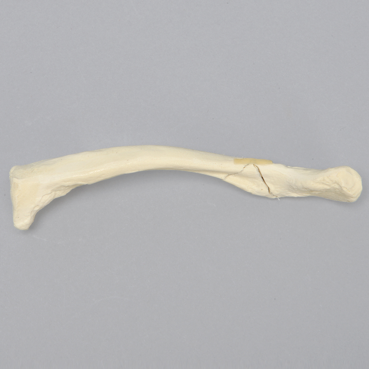 Kit Sawbones Fracturas de miembro superior