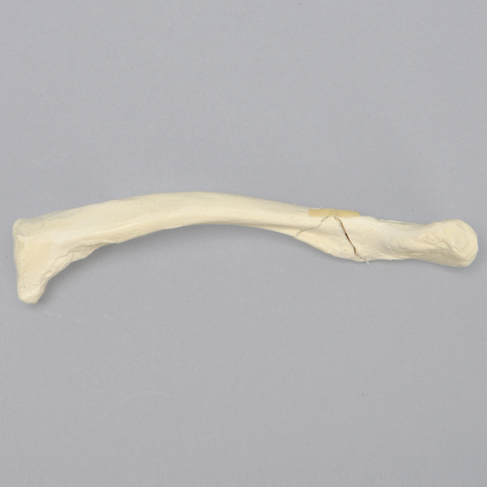 Kit Sawbones Fracturas de miembro superior