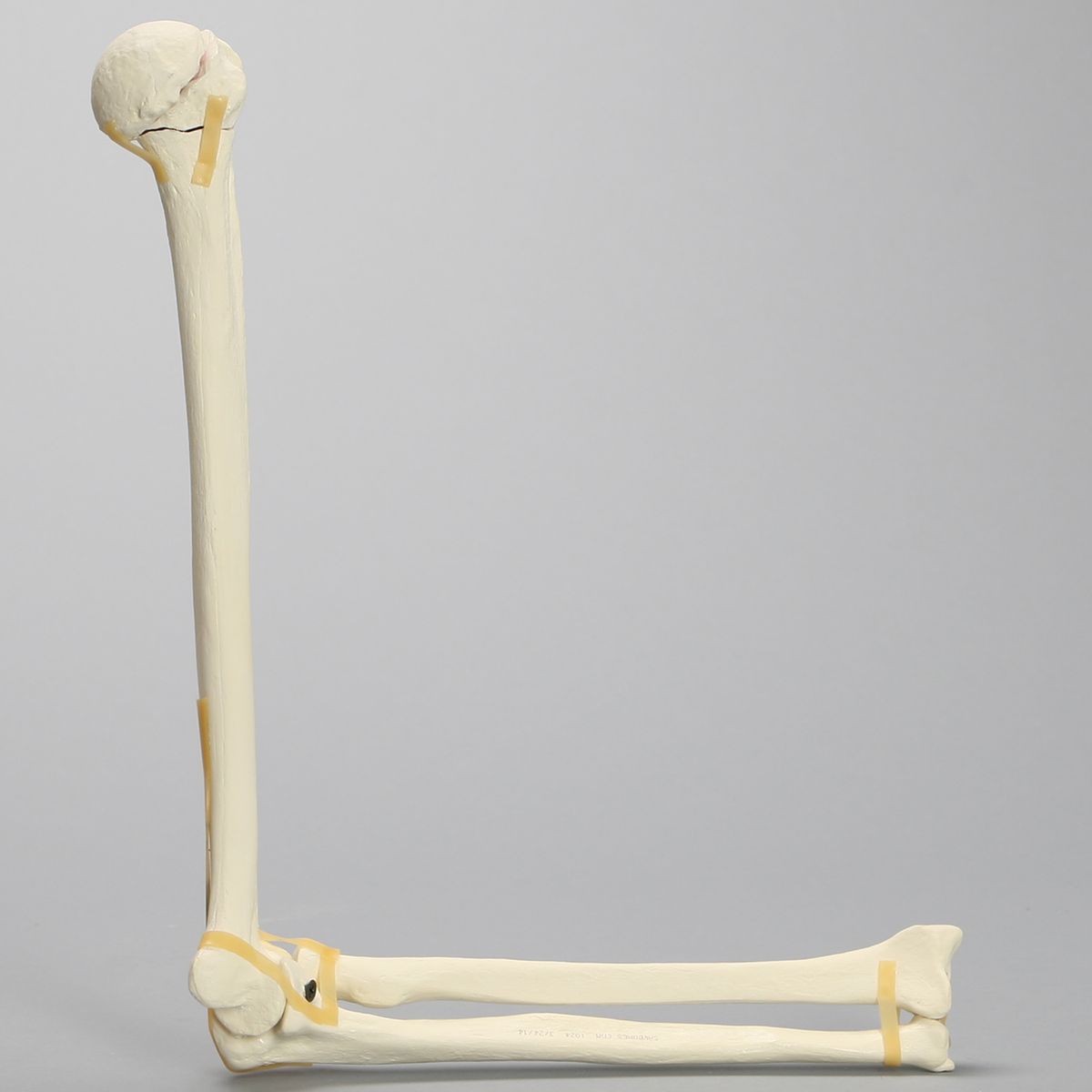 Sawbones Codo con fractura en cuatro partes