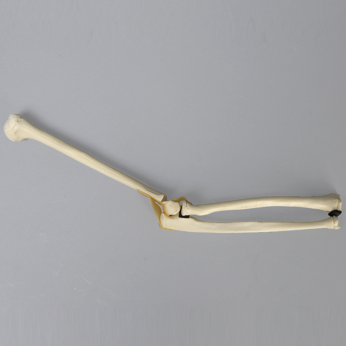 Sawbones Codo pediátrico con fractura distal