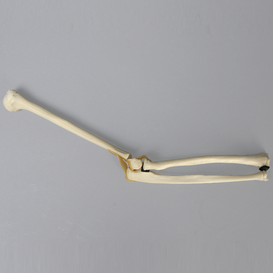 Sawbones Codo pediátrico con fractura distal