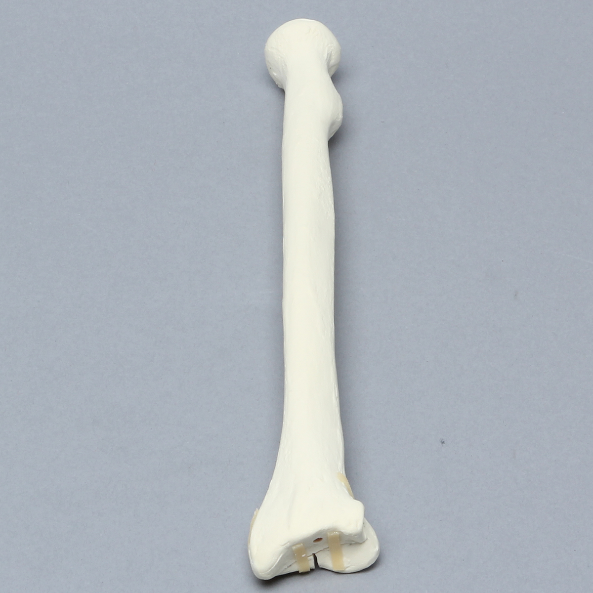 Sawbones Radio con fractura distal para placa volar