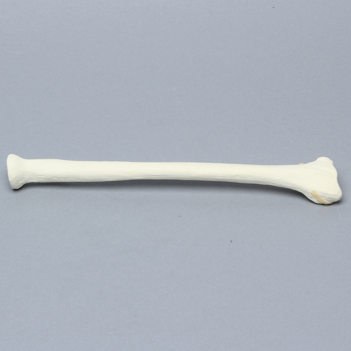 Sawbones Radio con fractura distal para placa volar
