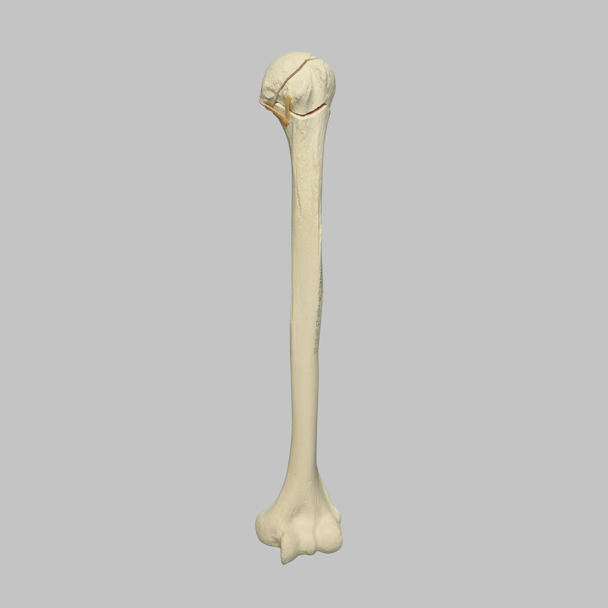 Sawbones Húmero con fractura de cabeza en cuatro partes