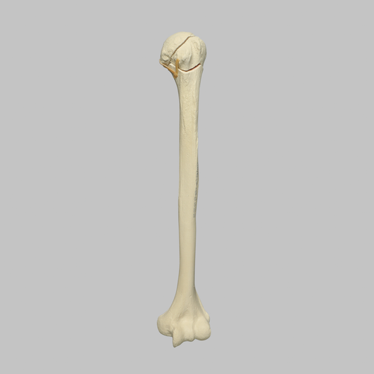 Sawbones Húmero con fractura de cabeza en cuatro partes