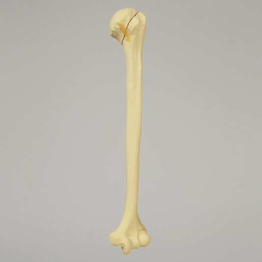 Sawbones Húmero con fractura de cabeza en tres partes