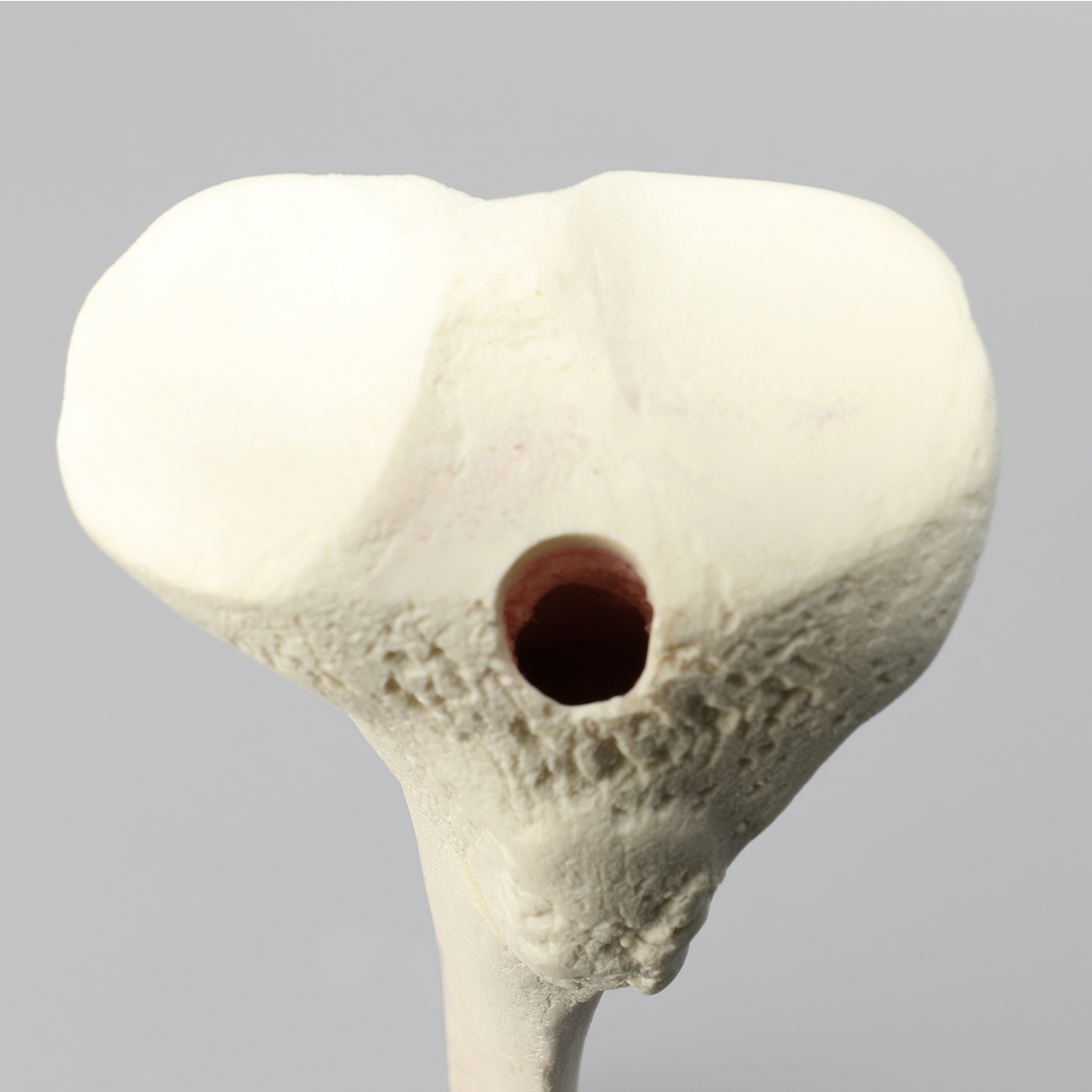 Sawbones Tibia con fractura oblicua para clavo endomedular