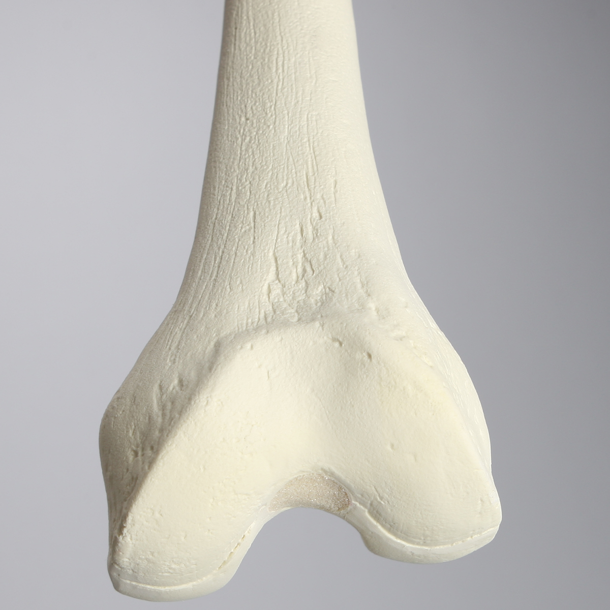 Sawbones Fémur cortical de espuma izquierdo mediano