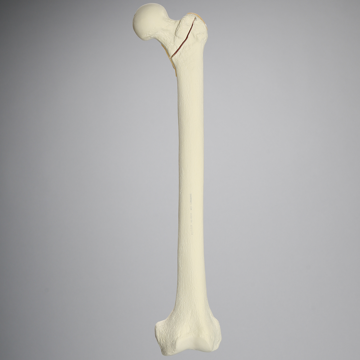 Sawbones Fémur con fractura intertrocantérica conminuta