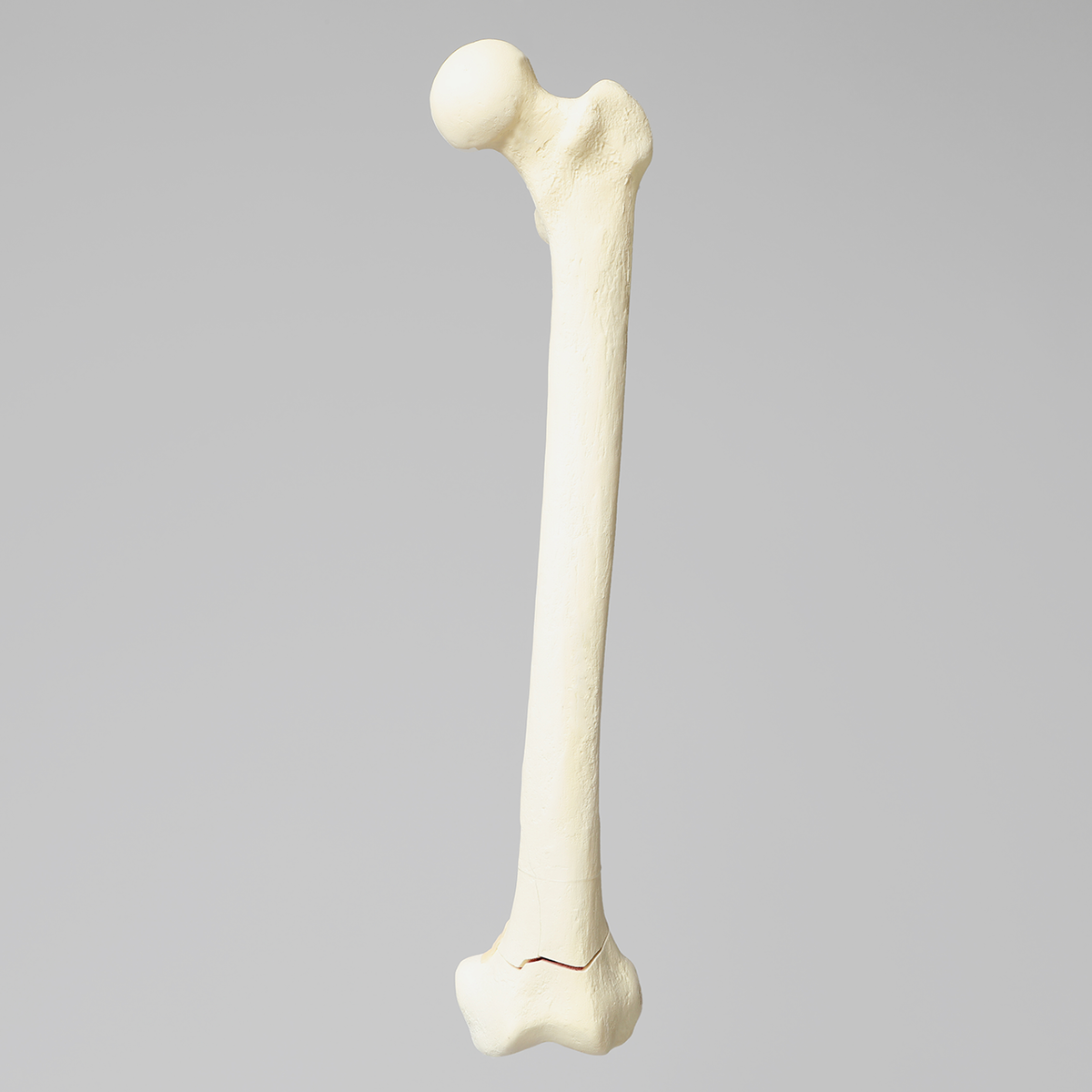 Sawbones Fémur con fractura transversal y fragmento