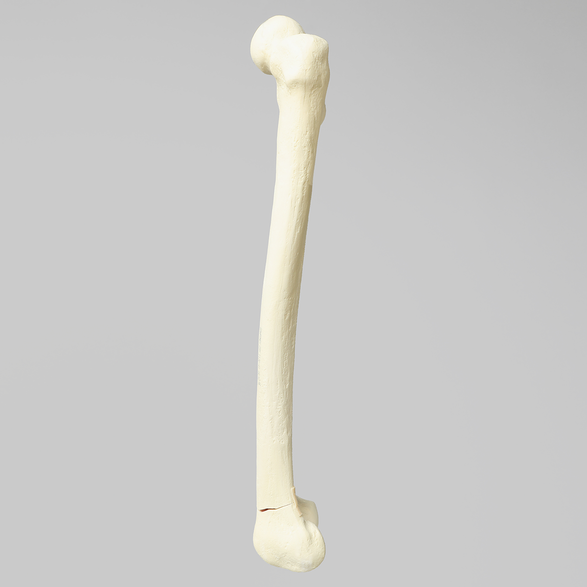 Sawbones Fémur con fractura transversal y fragmento
