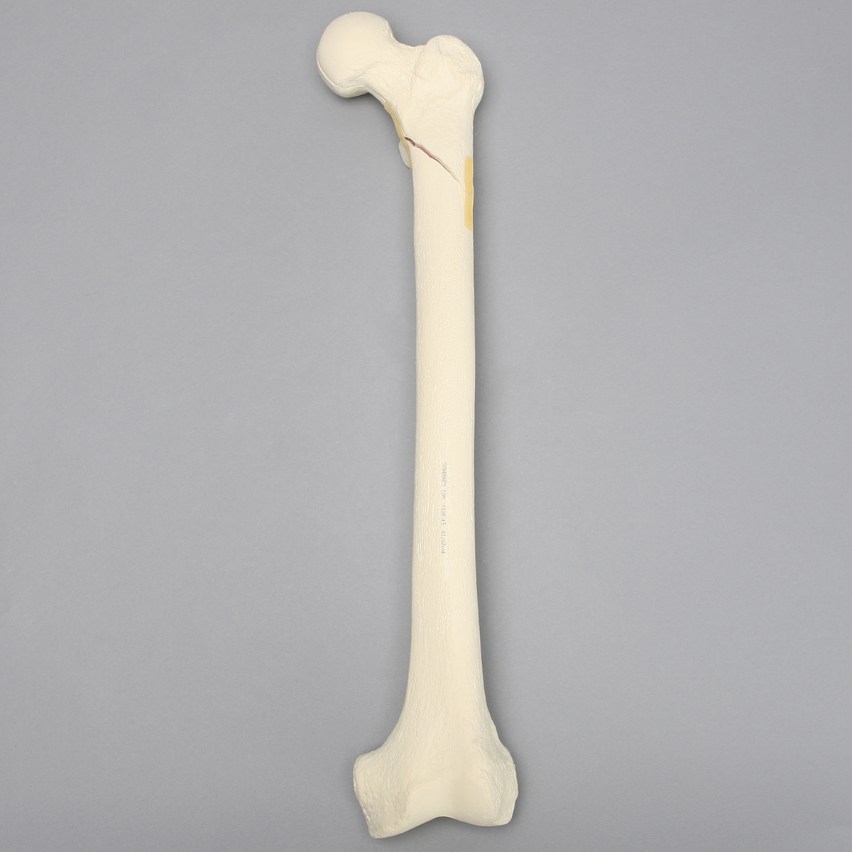 Sawbones Fémur con fractura subtrocantérica espiroidea