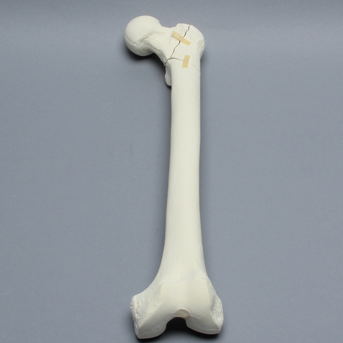 Kit Sawbones Fracturas de cadera