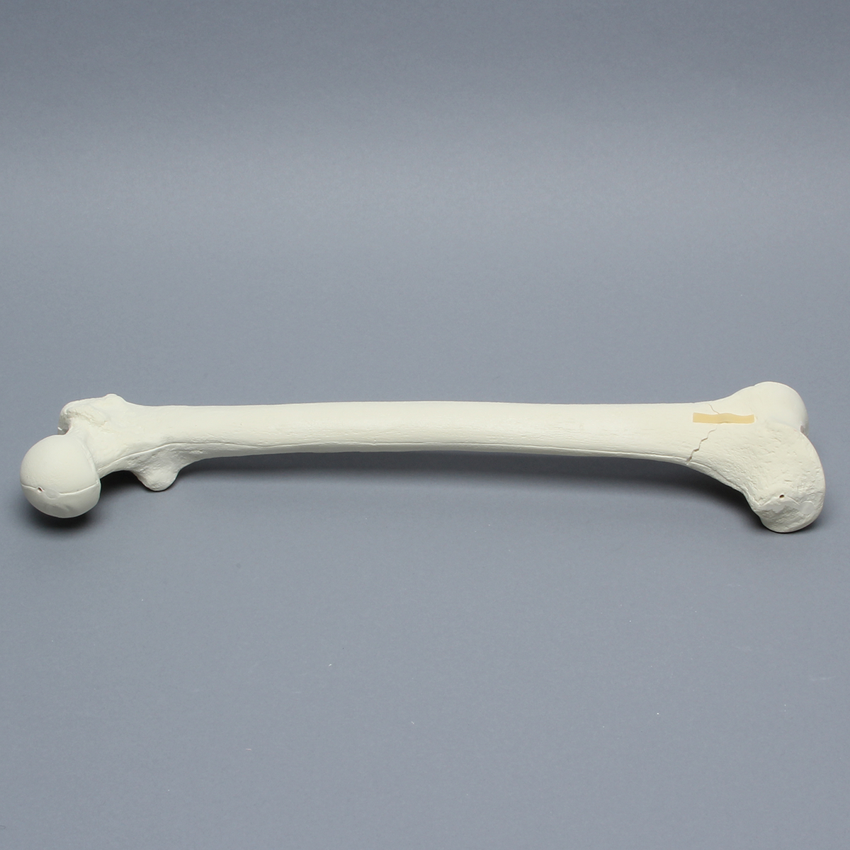 Sawbones Fémur con fractura supracondílea