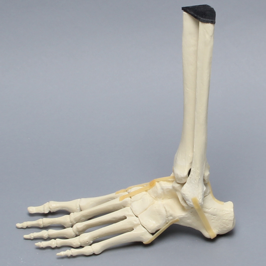 Sawbones Pie y tobillo con fractura de Lisfranc
