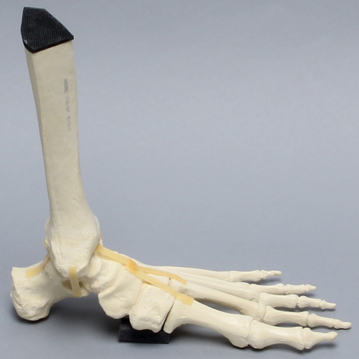 Sawbones Pie y tobillo con fractura de Lisfranc