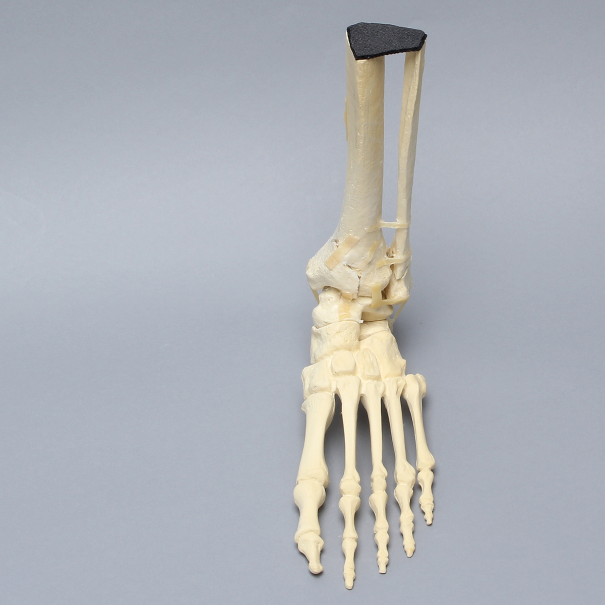 Sawbones Pie y tobillo con fractura de pilón tibial y peroné