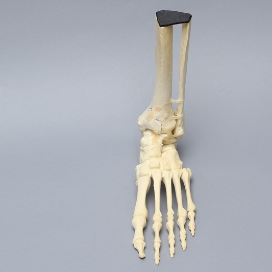 Sawbones Pie y tobillo con fractura de pilón tibial y peroné