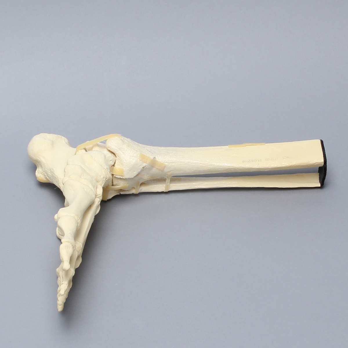 Sawbones Pie y tobillo con fractura de pilón tibial y peroné