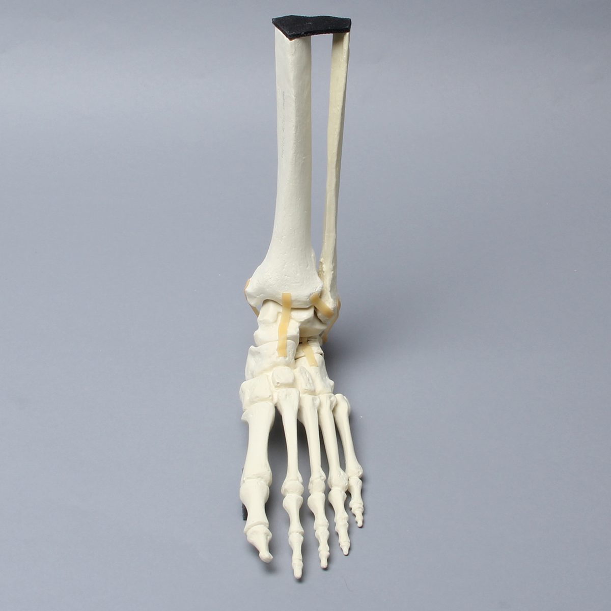Kit Sawbones Fracturas de tobillo y pie