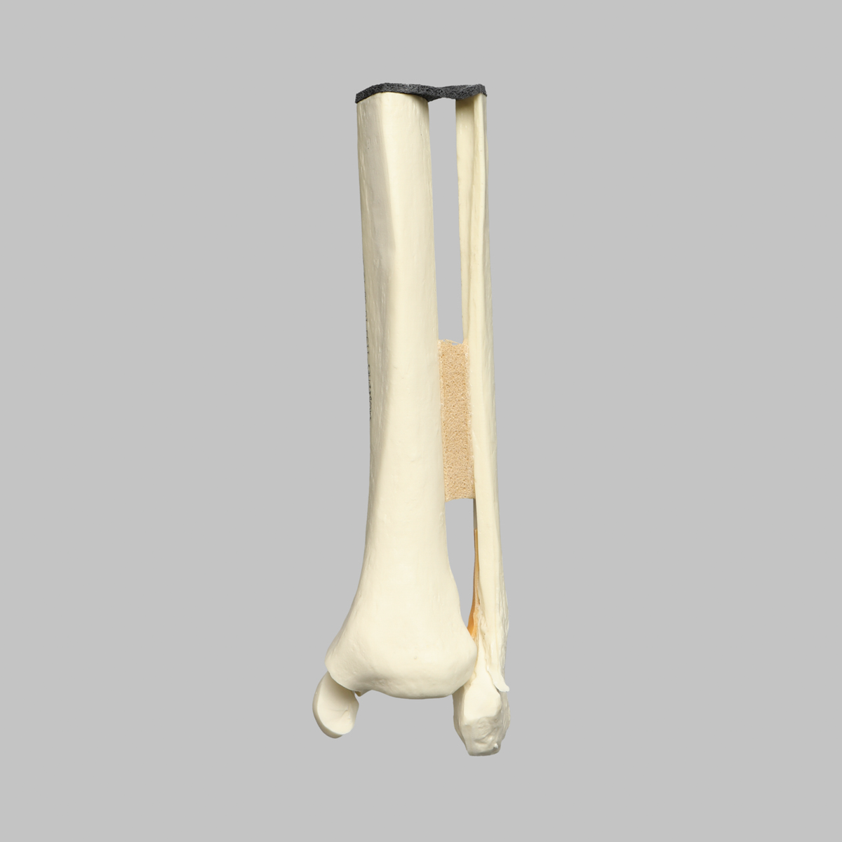 Kit Sawbones Fracturas de tobillo y pie
