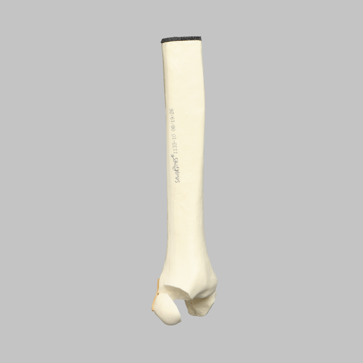 Sawbones Tobillo con fractura trimaleolar