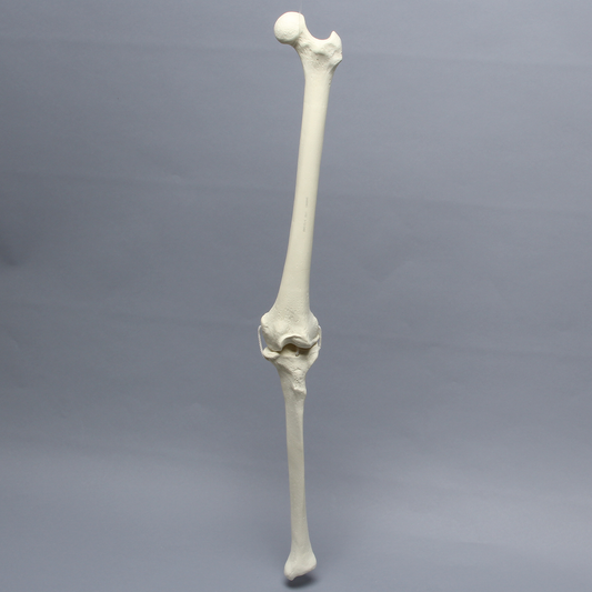Sawbones Rodilla artrósica con cuatro ligamentos