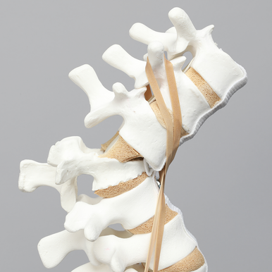Sawbones Columna lumbar con fractura por estallido de L1