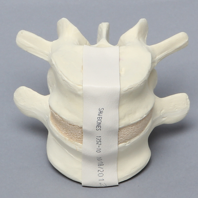 Sawbones Vértebras lumbares L4-L5 cortical de espuma