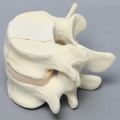 Sawbones Vértebras lumbares L4-L5 cortical de espuma