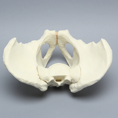 Sawbones Pelvis masculina con acetábulo artrósico