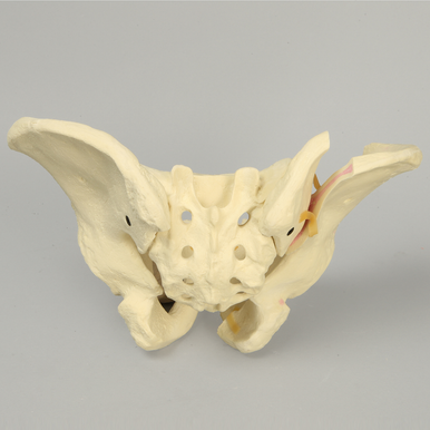 Sawbones Pelvis masculina con fracturas de ramas y sacroilíaca