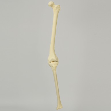 Sawbones Rodilla con deformidad en valgo de 10° del fémur distal