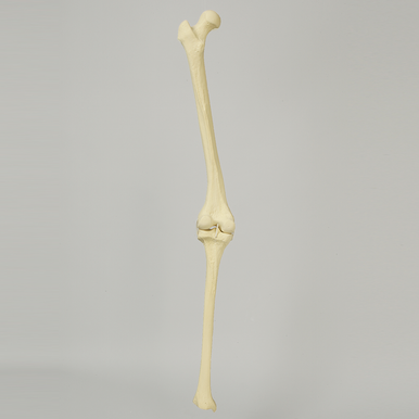 Sawbones Rodilla con deformidad en valgo de 10° del fémur distal