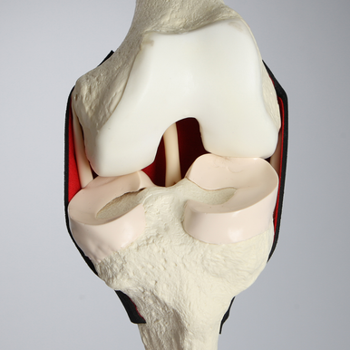 Sawbones Inserto de rodilla de repuesto para #1413-20