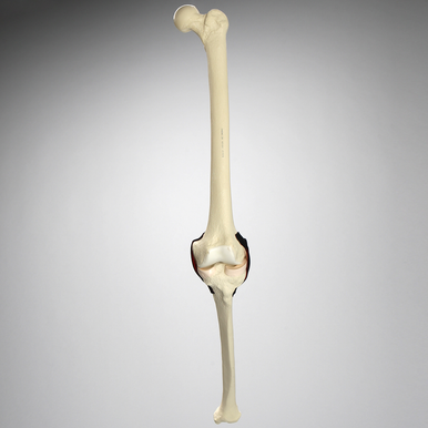 Sawbones Inserto de rodilla de repuesto para #1413-20