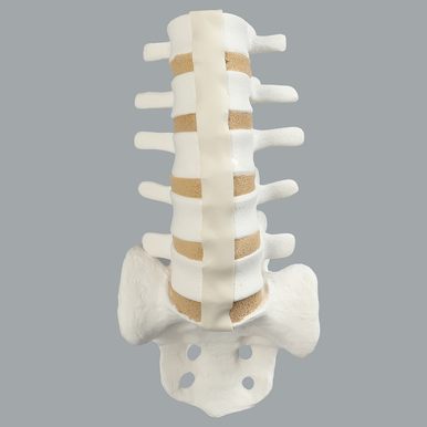 Sawbones Columna lumbar L1 a sacro cortical de espuma