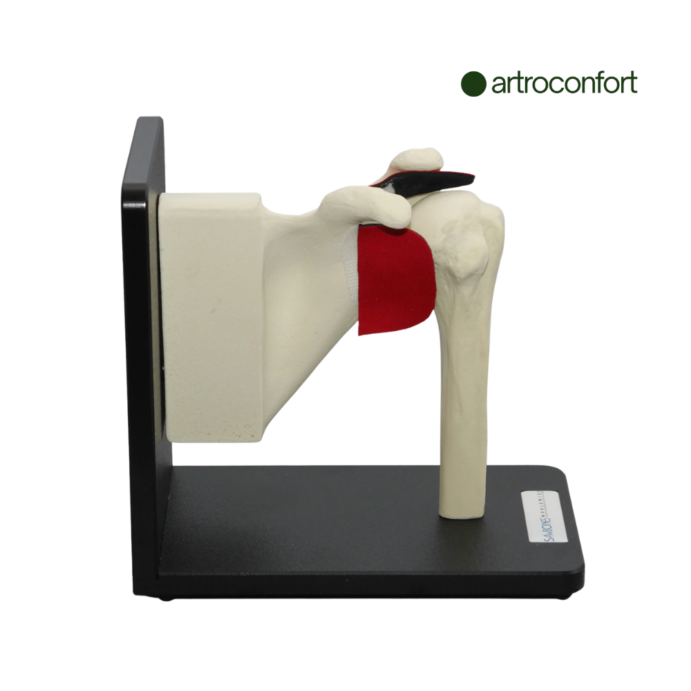 SAWBONES ENSAMBLE DE HOMBRO EN BASE CON PARTES REEMPLAZABLES CORTICAL DE ESPUMA