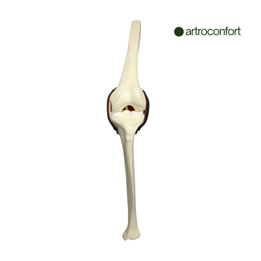 SAWBONES INSERTO DE RODILLA CON LCA ENCAPSULADO MEDIANO