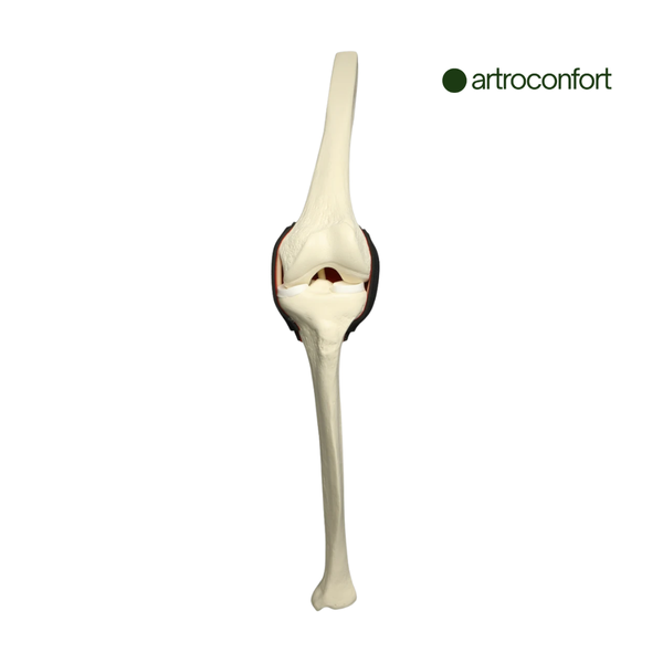 SAWBONES INSERTO DE RODILLA CON LCA ENCAPSULADO MEDIANO
