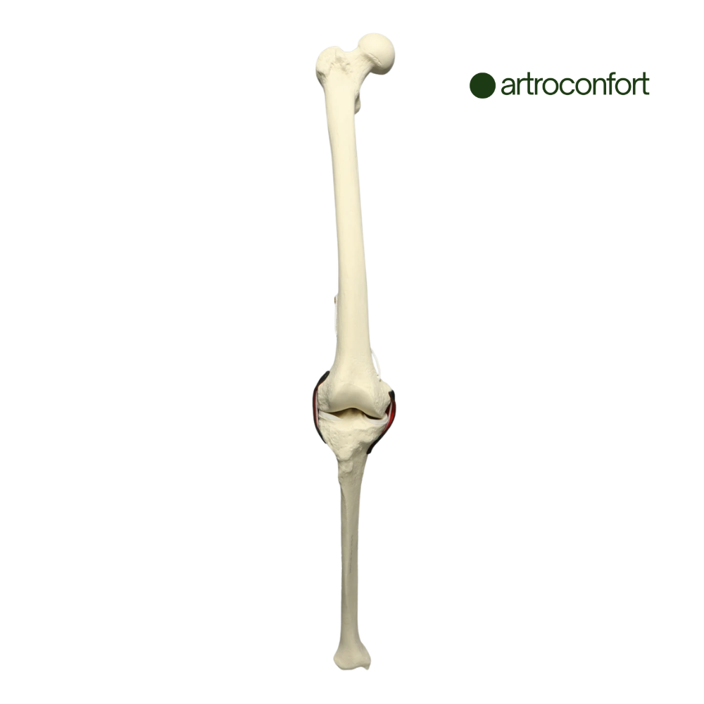 SAWBONES INSERTO DE RODILLA CON LCA ENCAPSULADO Y LIGAMENTO AJUSTABLE