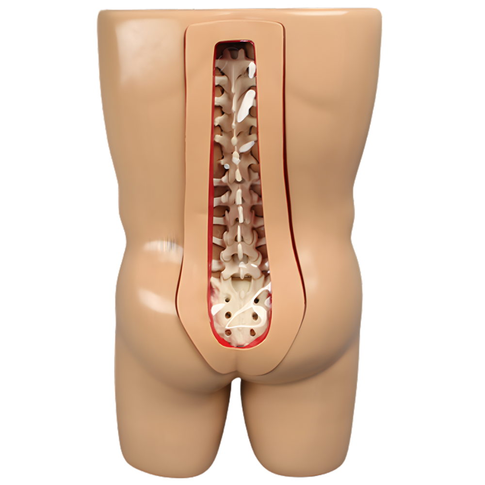 TRONCO PARA VERTEBROPLASTIA CON MODELO DE COLUMNA SAWBONES