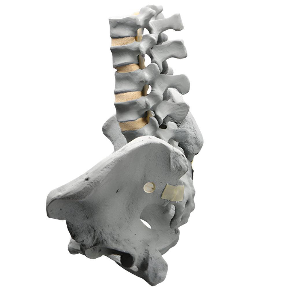 COLUMNA LUMBAR CON PELVIS COMPLETA MASCULINA, RADIOPACA SAWBONES